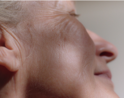 Skóra dojrzała: czy można zwolnić jej starzenie się, stosując odpowiednie serum?